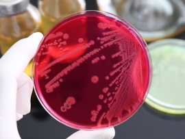 Salmonella was growth in (selective medium) XLD agar