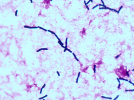 bacillus cereus